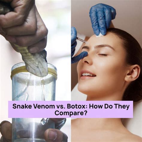 Snake Venom in Skincare: Wrinkle Fix or Hype? | Clinikally