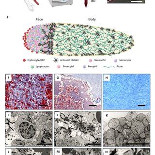 Image result for PRF Types