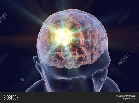 Image result for Brain Decimation