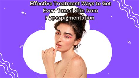 Get Even Toned Skin from Hyperpigmentation – EABHAA