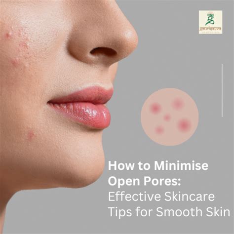 How to Minimize Open Pores: Effective Skincare Tips for Smooth Skin ...