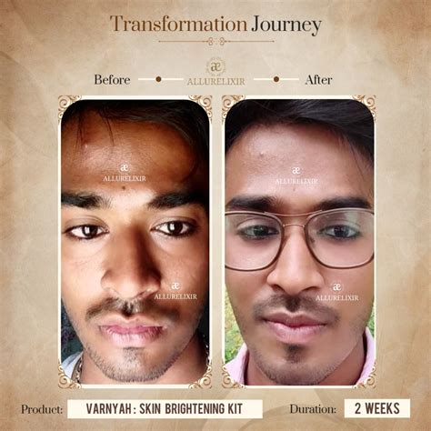 Varnyah Skin Brightening Pack | Best Facial Pack for Glowing Skin ...