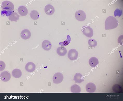 Plasmodium Blood Smear at Michael Nipper blog