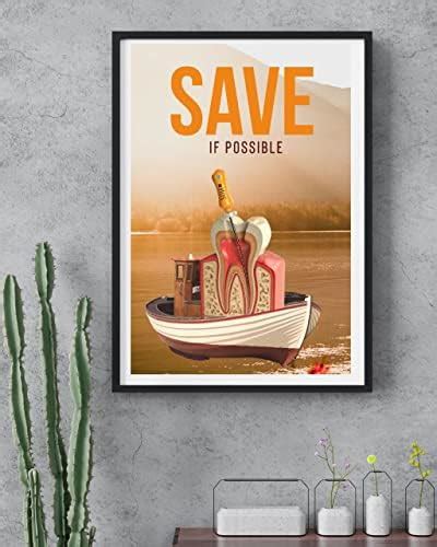 Root canal Dental Poster patient education without frame : Amazon.in ...