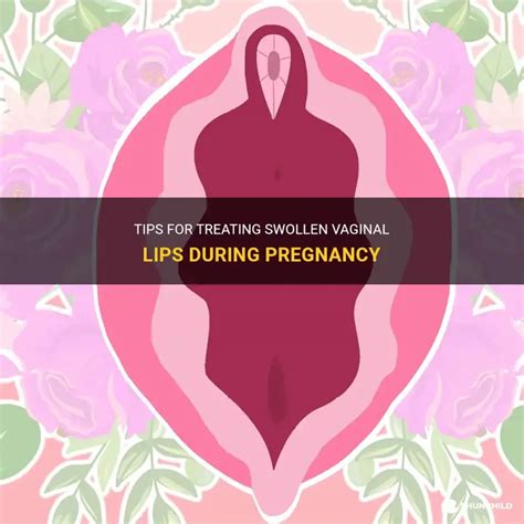 Smelly Vag During Pregnancy at Michele Fields blog