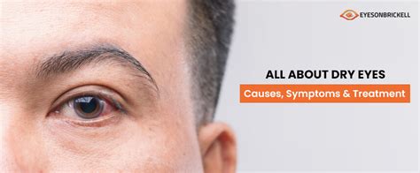 Dry Eyes Symptoms | Eyes on Brickell