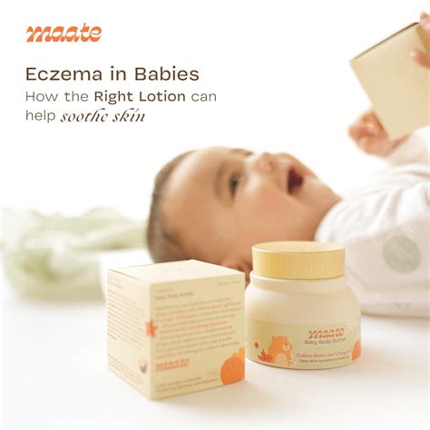 Eczema in Babies: How the Right Lotion Can Help Soothe Skin – Maate