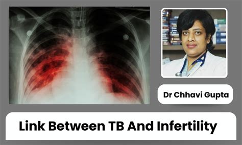 Do You Know TB Can Cause Infertility in Females and Males? - Dr Chhavi ...