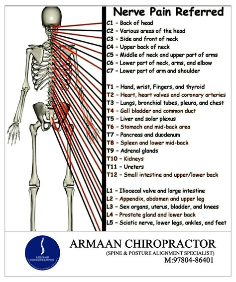 Back Pain Nerve Chart - back pain chart
