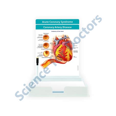Coronary Artery Disease: 2 Slides Patient Leaflet Tray – SMS Scientific ...