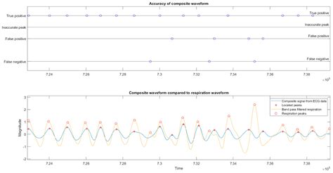 Combined Cardiac and Respiratory Monitoring from a Single Signal: A ...