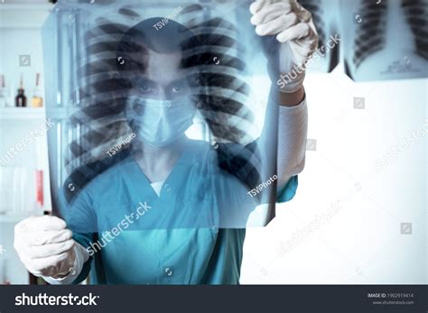Xray Of Ribs What Does The Doctor Say