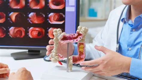 Alibaba unveils AI CT scan which detects colorectal cancer with 99.8% ...