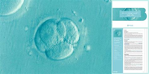 AQA GCSE Cell Biology Lesson 7: Stem Cells | Beyond