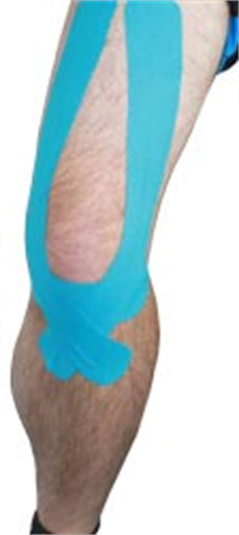 Knee Injury Meniscus Treatment