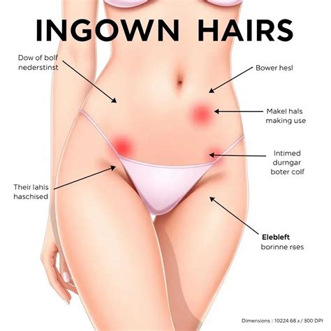 Remove Ingrown Hair Bikini Area Effectively | Hair Away By Laser