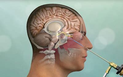 Best Neurosurgeon in Goregaon | Dr. Medha Vyas