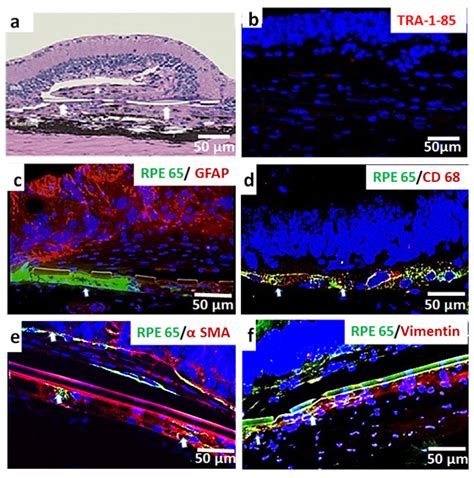 Long-Term Transplant Effects of iPSC-RPE Monolayer in Immunodeficient ...