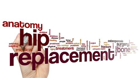 Image result for Tips Procedure Recovery