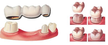 Benefits at Smilemakers
