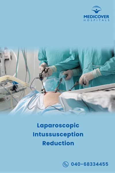 Hoos-u-dhigidda Intussusception Laparoscopic | Tilmaamaha & Soo kabashada