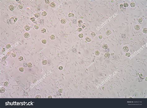 Bacteria Urine Specimen Under Microscope 400x Stock Photo 268541192 ...