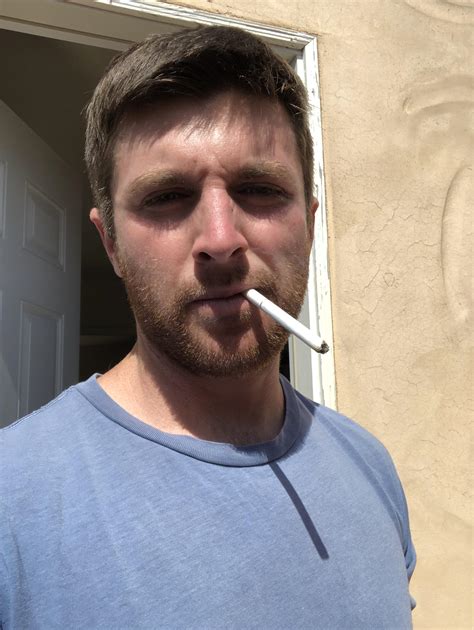 American spirit celadon. Bruise on my left cheek from a housemate who ...