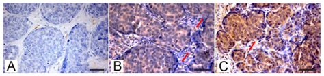 An Immunohistochemical Study of the PTEN/AKT Pathway Involvement in ...