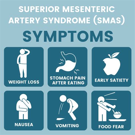 Getting SMAS-hed: A Guide for Learning Superior Mesenteric Artery Syndrome Causes, Signs, and ...