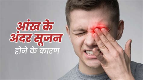 आंख के अंदर सूजन क्यों आ जाती है | Inflammation in Eye Causes in Hindi ...
