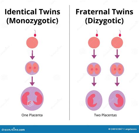 Difference between Identical and Fraternal Twins. Stock Vector ...