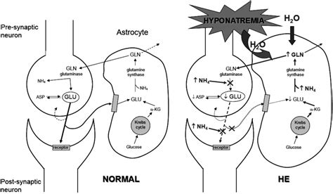 JCM | Special Issue : Hyponatremia: Advances in Diagnosis and Management