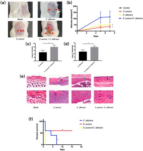 Staphylococcus aureus Synergized with Candida albicans to Increase the ...