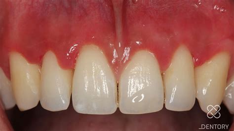 Case-Reports | Quintessenz Verlags-GmbH