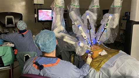 Robotic Laparoscopic Partial Hysterectomy at Ali Winston blog