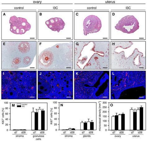 Indole-3-Carbinol Inhibits the Growth of Endometriotic Lesions by ...