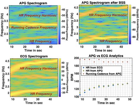 Audioplethysmography for cardiac monitoring with hearable devices