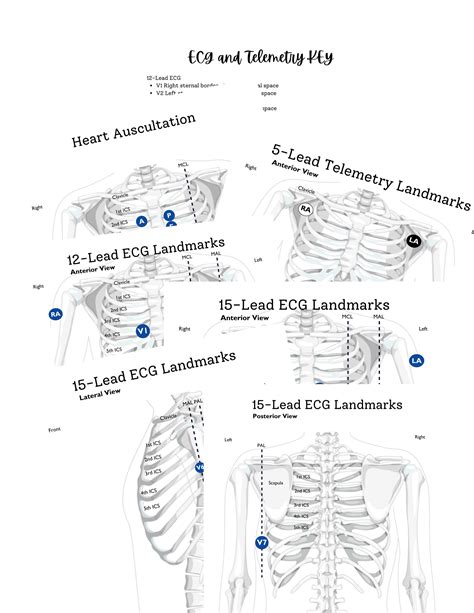 Diagram 15 Lead Ekg Placement Diagram Mydiagram Online/fallout 7 6 Lead ...