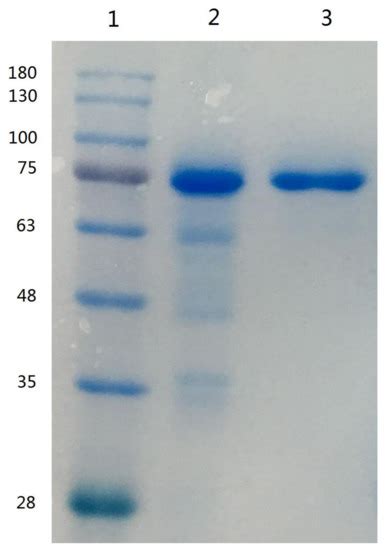 Determination of Lactoferrin in Camel Milk by Ultrahigh-Performance ...