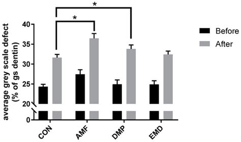 Remineralization of Artificial Dentin Caries Using Dentin and Enamel ...