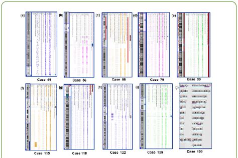 Image result for CytoScan Microarray OncoScan