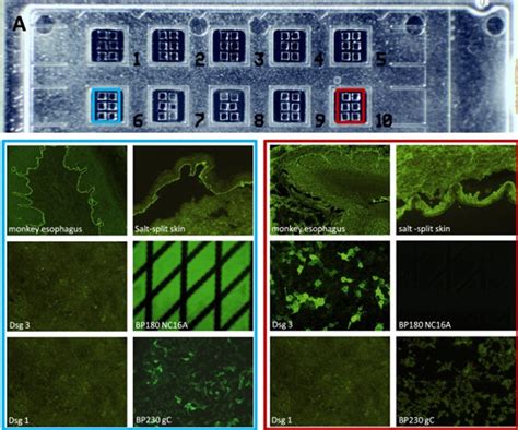 Dermatopathology Society of India Mid-Month Mindbender
