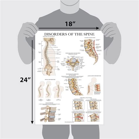 Palace Learning Disorders of the Spine Anatomy India | Ubuy