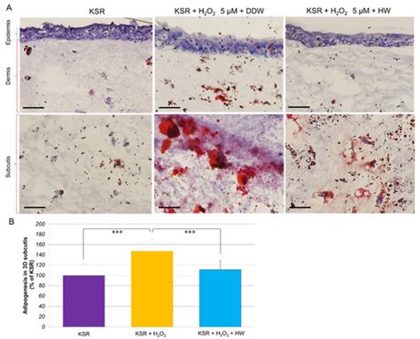 Hydrogen Nano-Bubble Water Suppresses ROS Generation, Adipogenesis, and ...