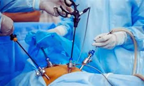 Minimally Invasive Pancreatoduodenectomy Noninferior to Open Surgery ...