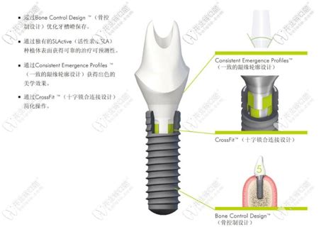 iti种植工具盒图谱,登腾种植工具盒,登腾种植工具盒讲解(第2页)_大山谷图库