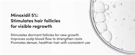 Man Matters Minoxidil 5% with Finasteride Solution Serum I Prevent Hair ...