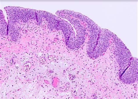 Urinary Bladder Histology Submucosa
