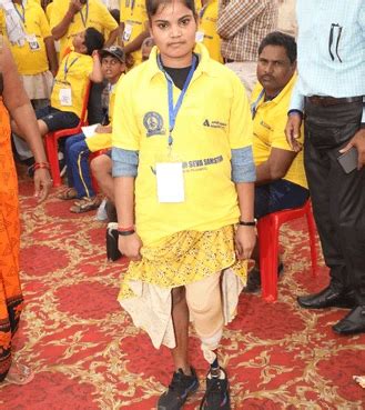 Best Artificial Limbs Cost in India - Artificial Prosthetic Leg Centre ...