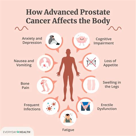Prostate Cancer Symptoms And Prognosis